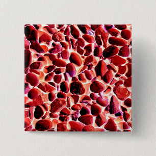 BADGE CARRÉ 5 CM PEBLES DE PLAGE