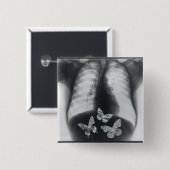 Badge Carré 5 Cm Rayon X des papillons dans l'estomac (Devant & derrière)