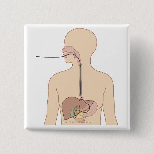 Badge Carré 5 Cm Route de l'Endoscope (Devant)