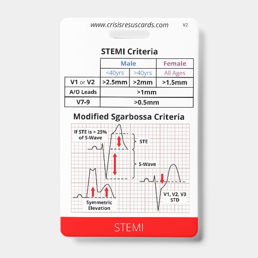 Badge ECG à haut risque/STEMI (Avant)