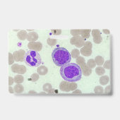 Badge Laboratoire d'hématologie du microscope à diaposit (Arrière)