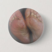 BADGE ROND 5 CM BOUTON D'ALIMENTATION UNIQUE (Devant)