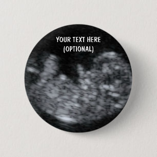 Badge Rond 5 Cm Image personnalisée Ultrasound pour bébé