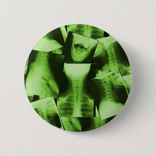 Badge Rond 5 Cm Rayé X - Vert radioactif (Devant)