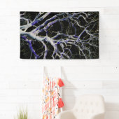 Banderoles Côté foncé 5 bnrcna (En situation)