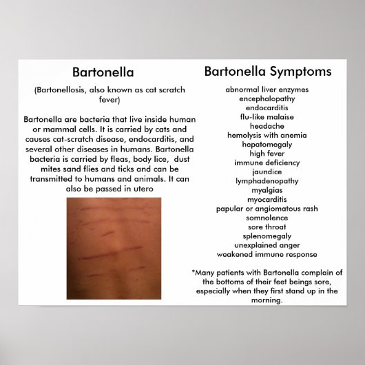 Bartonella Symptoms Educatief Poster (Voorkant)