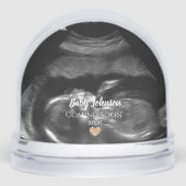 Bébé à venir bientôt échographie Cœur en or (Avant)