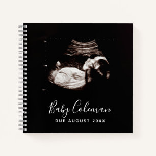 Bébé Sonogramme Mémoire personnalisée Livre de gro