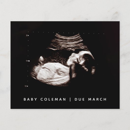 Begroting Zwangerschap Baby Sonogram Ultrageluid F Flyer (Voorkant)