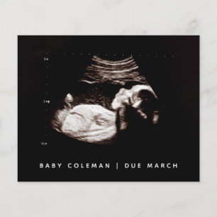 Begroting Zwangerschap Baby Sonogram Ultrageluid F Flyer
