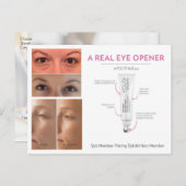 Behandeling van jonge ogen briefkaart (Voorkant / Achterkant)