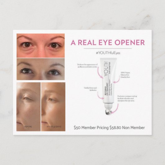 Behandeling van jonge ogen briefkaart (Voorkant)