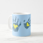 Bewustmaking van het downsyndroom koffiemok (Voorkant links)