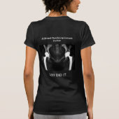 Bilaterale totale heupvervanging T-shirt (Achterkant)