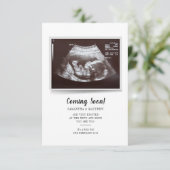 Binnenkort beschikbaar in script Ultrasound foto's (Staand voorkant)