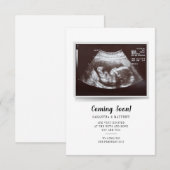 Binnenkort beschikbaar in script Ultrasound foto's (Voorkant / Achterkant)