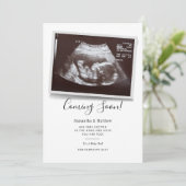 Binnenkort beschikbaar script Ultrasound Sonogram  Aankondiging (Staand voorkant)