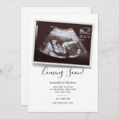 Binnenkort beschikbaar script Ultrasound Sonogram  Aankondiging (Voorkant / Achterkant)