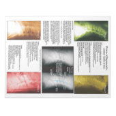 Bloc-note Éteindre La Dégénérescence De La Moelle De Lumière (Devant)