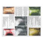 Bloc-note Éteindre la subbluxation de Pad Dégénération cervi (Devant)