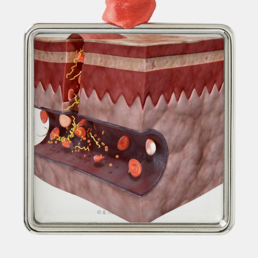 Bloedklokvorming Metalen Ornament (Voorkant)