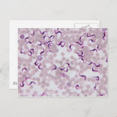Bloedparasiet Trypanosoma Briefkaart (Voorkant / Achterkant)