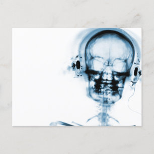 Blue X-Ray Vision Music Skeleton Skull Briefkaart