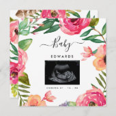 Boho Floral Sonogram Zwangerschap Aankondiging (Voorkant / Achterkant)