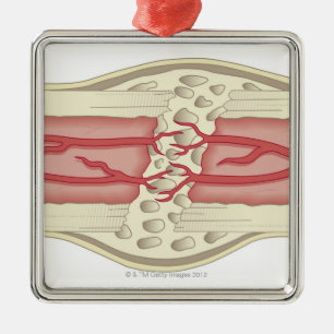 Bone die zichzelf herstelt 2 metalen ornament