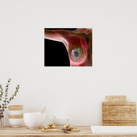Borstkanker 2 poster (Keuken)