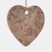 Borstkanker onder de microscoop keramisch ornament (Rechts)