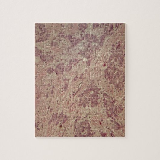 Borstkanker onder de microscoop legpuzzel (Verticaal)