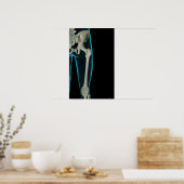 Botten van de Hip 2 Poster (Keuken)