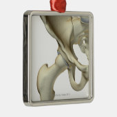 Botten van de Hip 5 Metalen Ornament (Rechts)