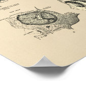  Botten van de Huid 1880 Afdrukken Poster (Hoek)