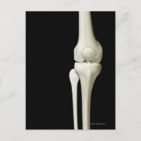 Botten van de knie 4