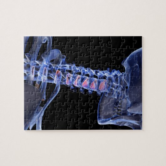 Botten van de nek 3 legpuzzel (Horizontaal)