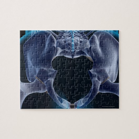 Botten van de Pelvis Legpuzzel (Horizontaal)