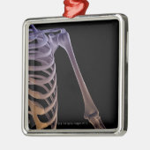 Botten van de schouder metalen ornament (Links)