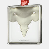 Botten van het staartbeen metalen ornament (Links)