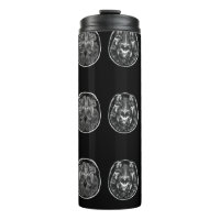 Analyse Mri du cerveau