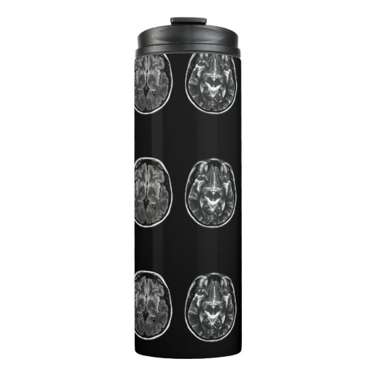 Bouteilles Isothermes Analyse Mri du cerveau (Devant)