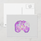 Brain Briefkaart (Voorkant / Achterkant)