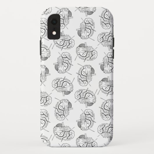 Brain Diagrammen Patroon Antiek Medisch Case-Mate iPhone Case (Achterkant)