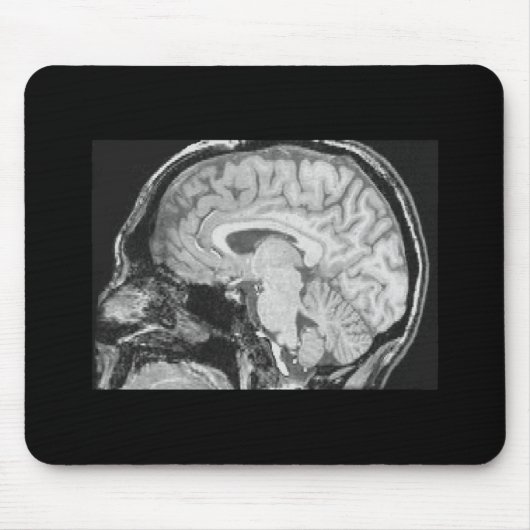 Brain MRI Muismat (Voorkant)