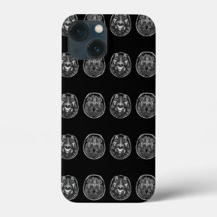 Brain mri scan iPhone 13 mini hoesje