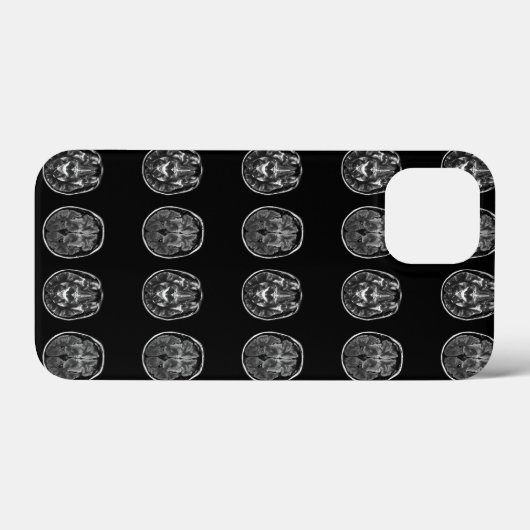 Brain mri scan Case-Mate iPhone case (Achterkant (horizontaal))