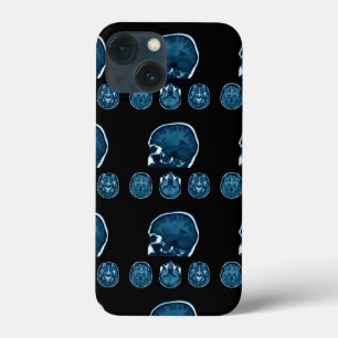 Brain Mri scan iPhone 13 Mini Hoesje