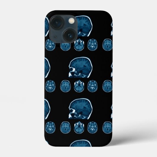 Brain Mri scan Case-Mate iPhone Case (Achterkant)