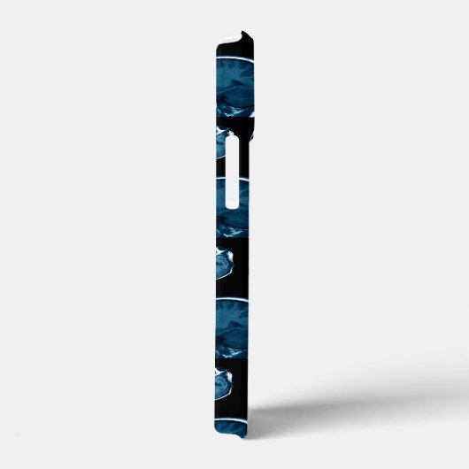 Brain Mri scan Case-Mate iPhone Case (Achterkant / Rechts)